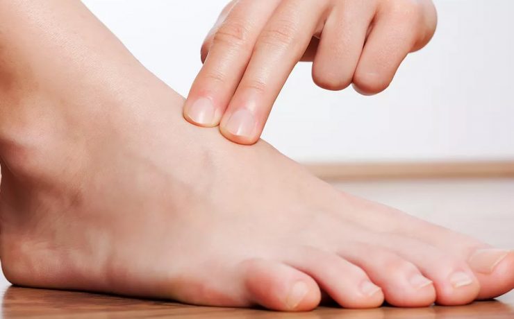 Diabetes and Feet