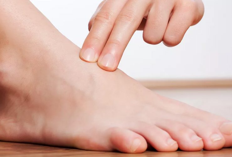 Diabetes and Feet